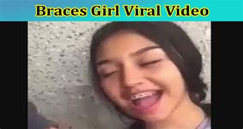 [Full Original Video] Braces Girl Viral Video: Check The Content。